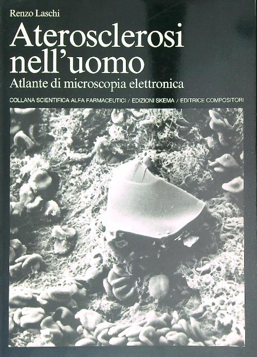 Aterosclerosi nell'uomo Atlante di microscopia elettronica - Renzo Laschi - copertina