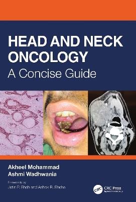 Head and Neck Oncology: A Concise Guide - Akheel Mohammad,Ashmi Wadhwania - cover