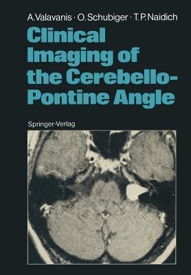 Clinical Imaging of the Cerebello-Pontine Angle - Anton Valavanis,Othmar Schubiger,Thomas P. Naidich - cover