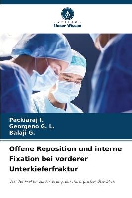 Offene Reposition und interne Fixation bei vorderer Unterkieferfraktur - Packiaraj I,Georgeno G L,Balaji G - cover
