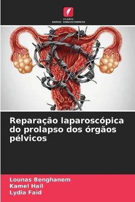 Repara??o laparosc?pica do prolapso dos ?rg?os p?lvicos - Lounas Benghanem,Kamel Hail,Lydia Faid - cover
