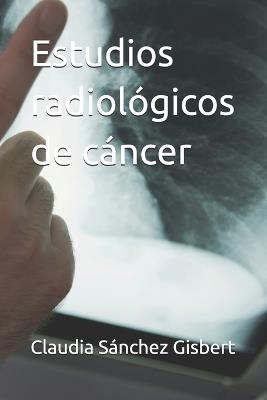 Estudios radiológicos de cáncer - Claudia Sánchez Gisbert - cover